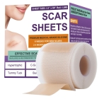 Silicone Scar Sheets